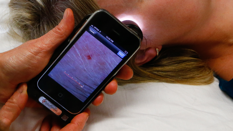 Phoning it in is not always the answer for skin cancer detection