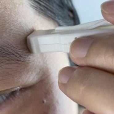 UQ microbiopsy deal could change the way skin conditions are diagnosed