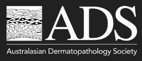 APD.png