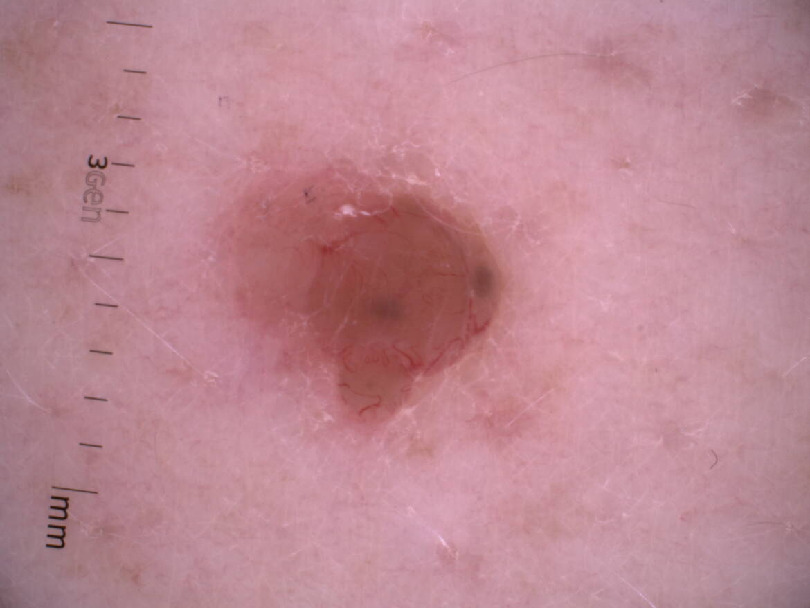 BCC-1.jpg