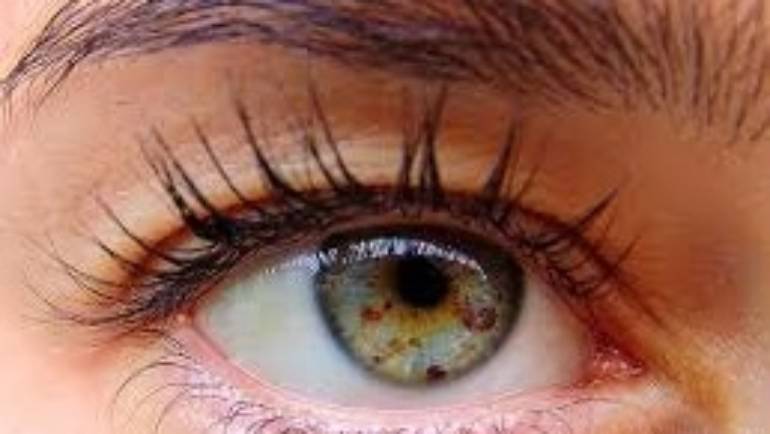 Melanoma is in the eye of the beholder